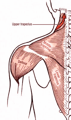 traps-diagram