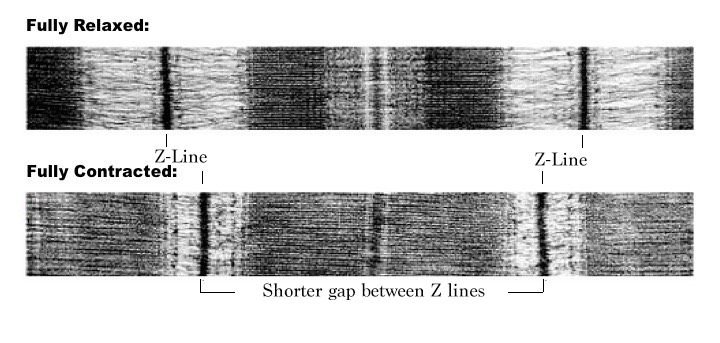 muscle sarcomere